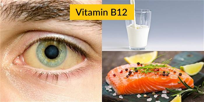 Triệu chứng nguy hiểm khi thiếu Vitamin B12