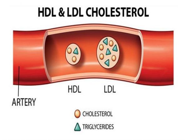 Các loại cholesterol